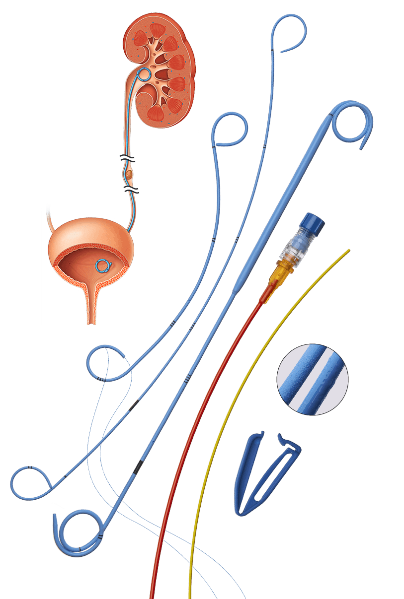 Ureteric stents